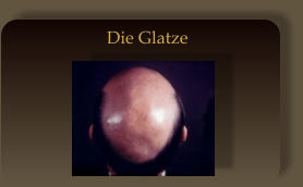 Die Glatze